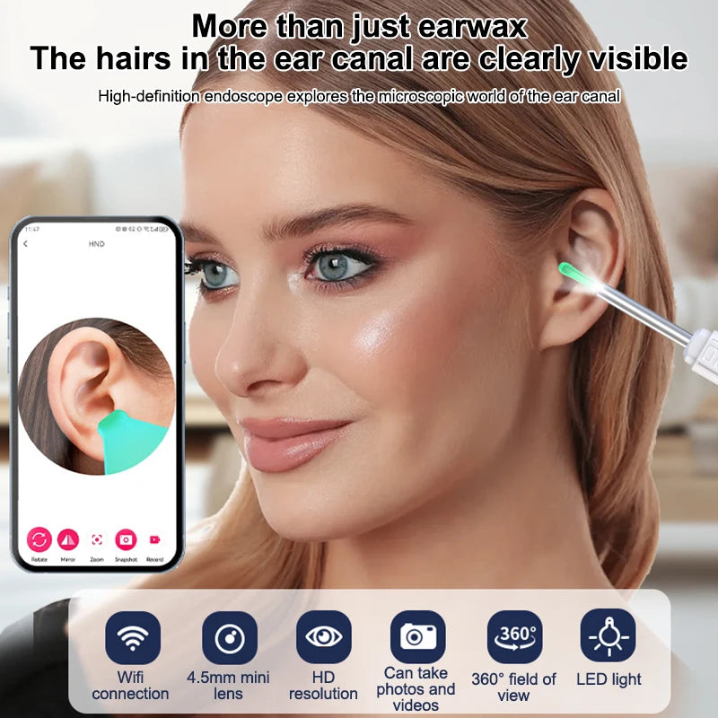 Intelligent WiFi Ear Health Device with Live Camera & LED Lighting, Solid ABS Plastic, Easy Transportation Design