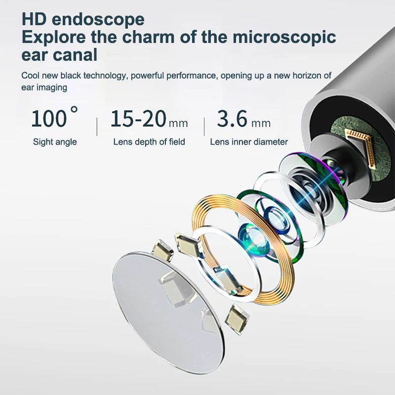 Intelligent WiFi Ear Health Device with Live Camera & LED Lighting, Solid ABS Plastic, Easy Transportation Design